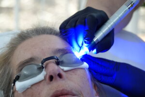 Blue Derma New Pictures DSC09516 1 elektrostimulator