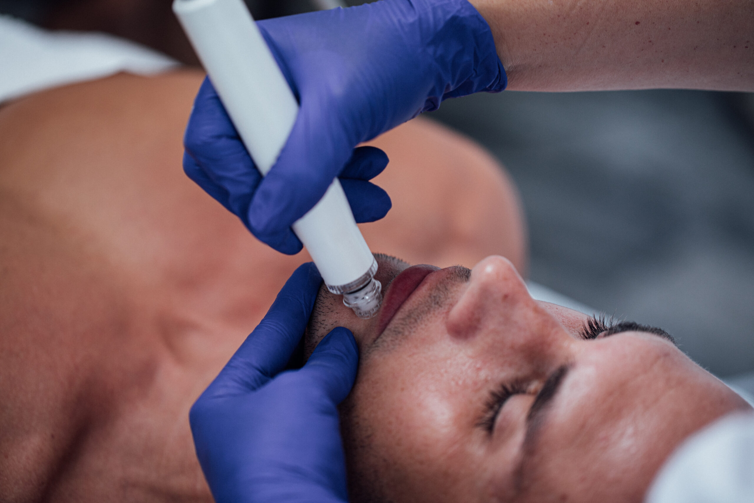 IDB Application Images ONA 290A0102 scaled elektrostimulator