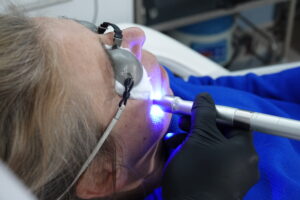 Blue Derma New Pictures DSC09487 1 elektrostimulator