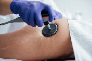 IDB Application Images EDNA PRO MAX Contouring elektrostimulator