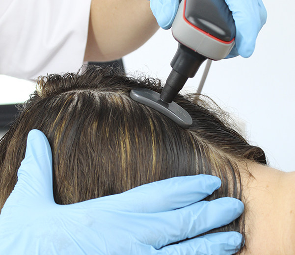 IDB Application Images EDNA PRO MAX Hair Treatment elektrostimulator