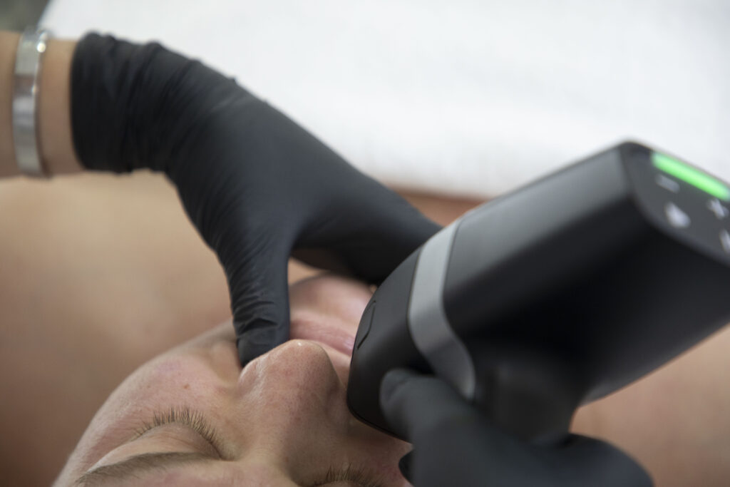 Reverso Application Images 371A6048 elektrostimulator